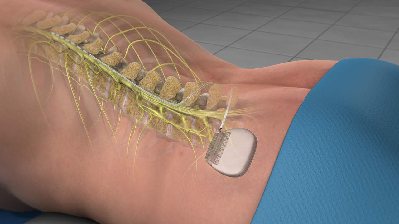 Anatomy Of Lower Back (Lumbar Spine) Pain - Spinomax