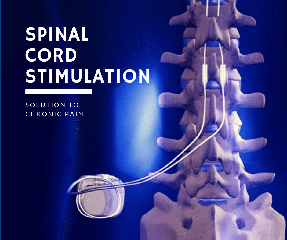 New and Improved Spinal Cord Stimulators Offer Drug-Free Relief for Chronic Back  Pain: Summit Pain Alliance: Pain Management Specialists
